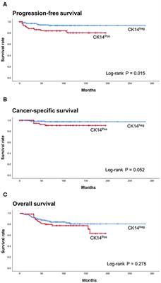 CK14 Expression Identifies a Basal/Squamous-Like Type of Papillary Non-Muscle-Invasive Upper Tract Urothelial Carcinoma